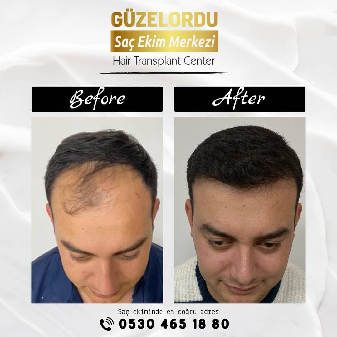 Güzel Ordu, 9 Şubat 2024 tarihli fotoğraf paylaşımı