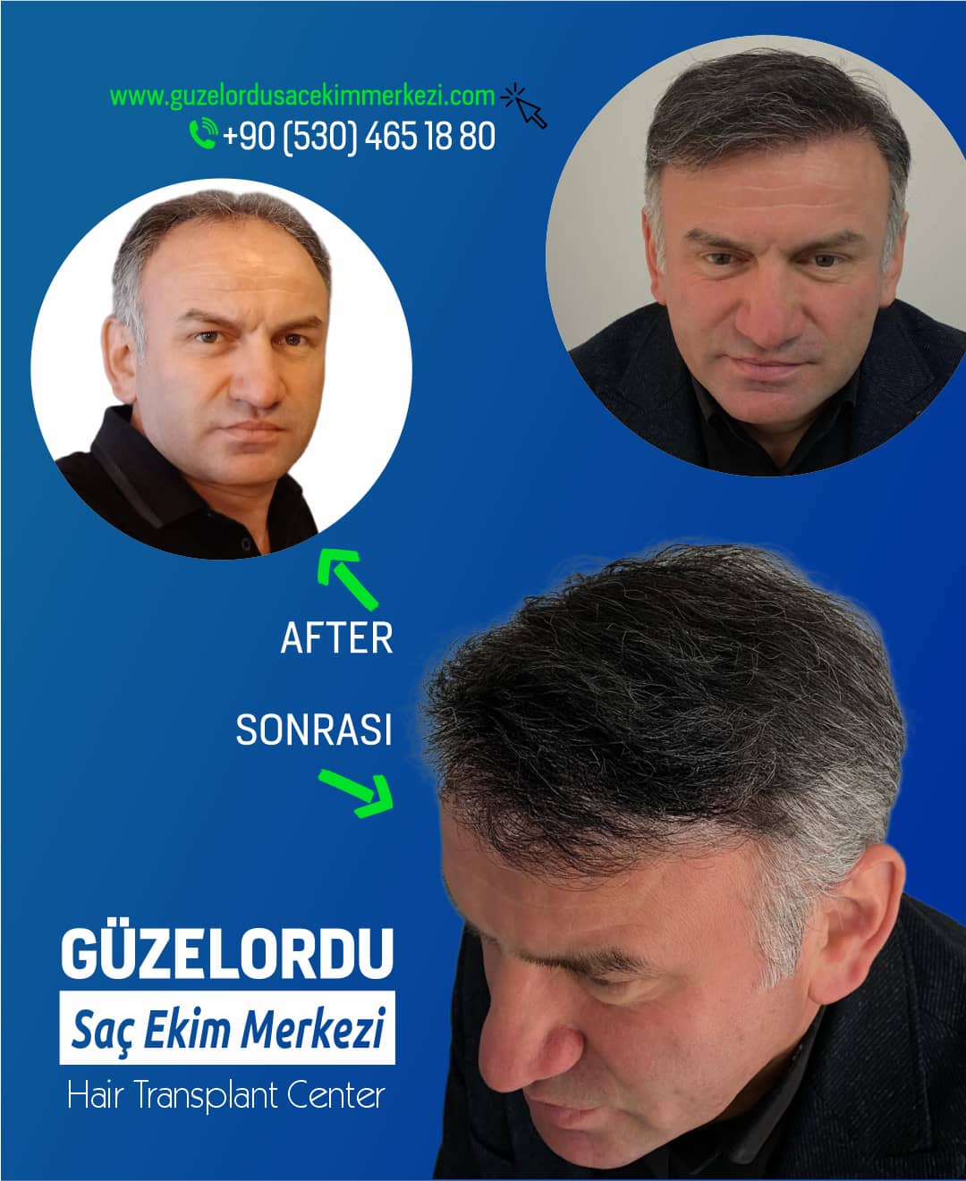 Güzel Ordu, 4 Şubat 2026 tarihli fotoğraf paylaşımı
