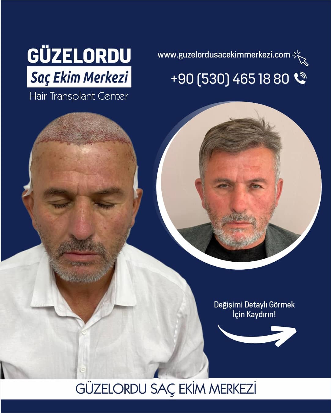 Güzel Ordu, 13 Nisan 2026 tarihli fotoğraf paylaşımı